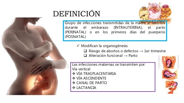 infecciones perinatales torch
